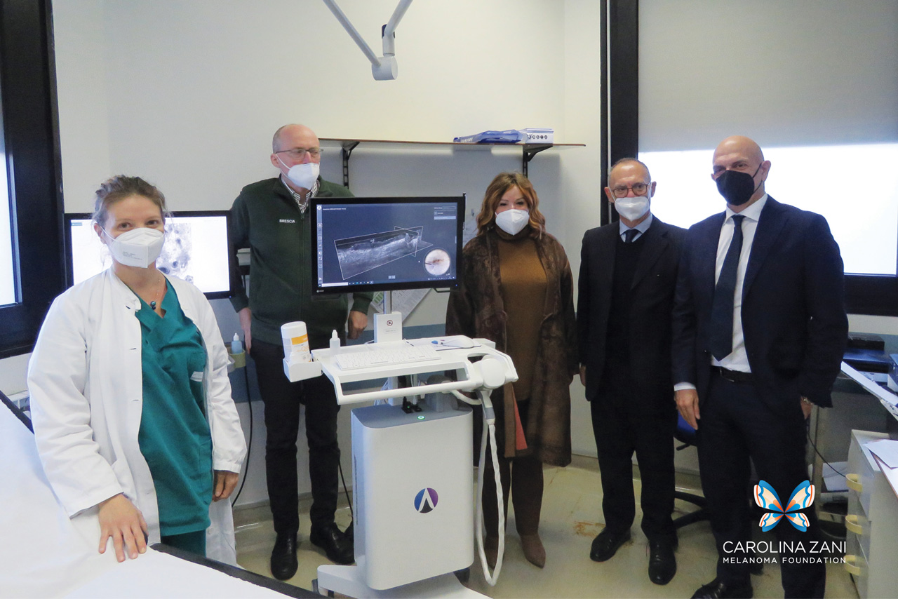 Donazione macchinari spedali civili per prevenzione Melanoma